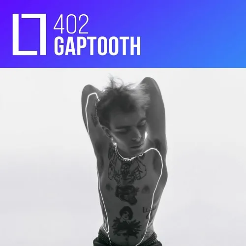 402 - Gaptooth