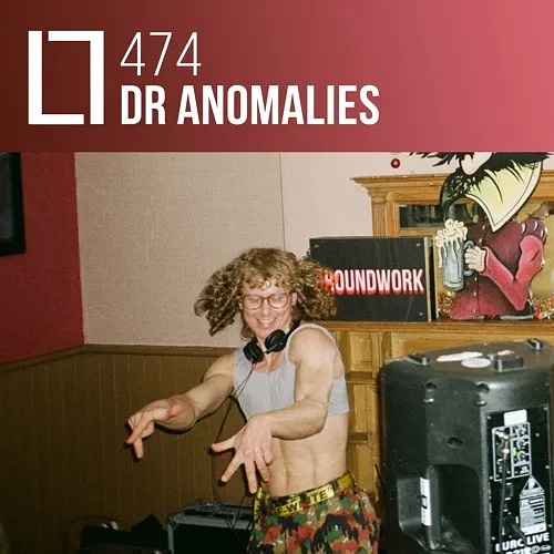 474 - Dr Anomalies